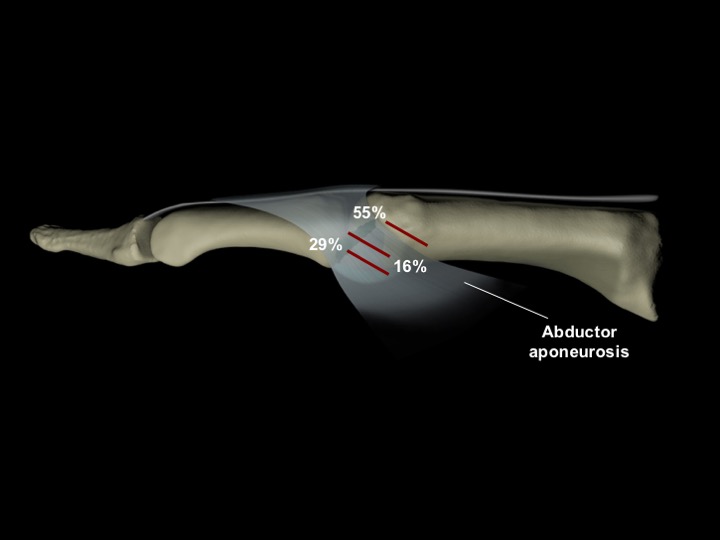 Figure 4 for case Complete proximal tear of the radial collateral ligament of the MPJ of the thumb